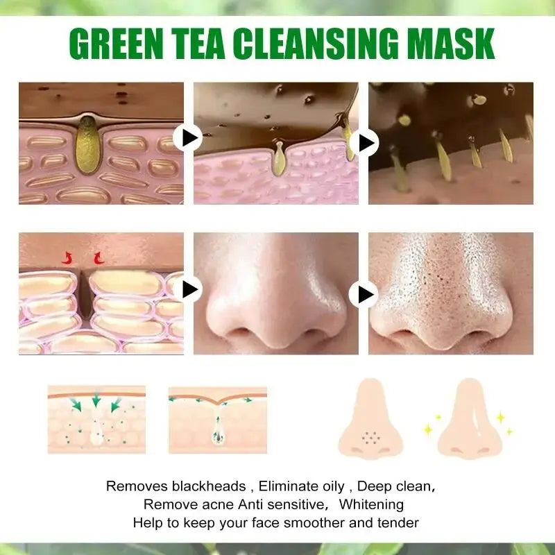 Original Facial Remove Blackhead Green Tea Solid Mask Treat Acne Blemish Black Dots Clean Stick Cream Shrink Pores Skin Care 
