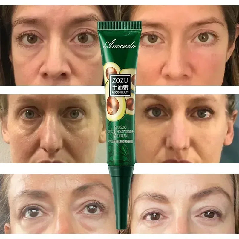 Instant Remove Wrinkles Eye Cream Fade Eye Fine Line Anti Aging Dark Circles Bags Puffiness Tighten Under Eyes Skin Care 2024