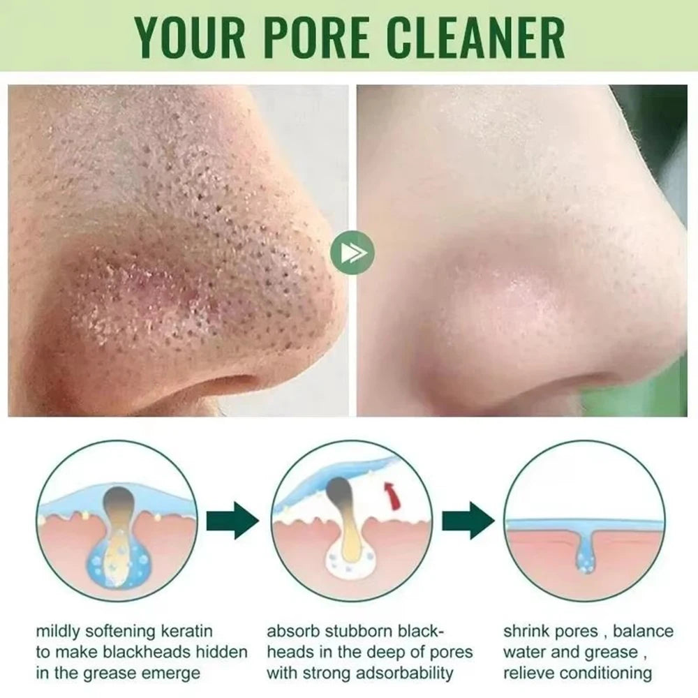Original Facial Remove Blackhead Green Tea Solid Mask Treat Acne Blemish Black Dots Clean Stick Cream Shrink Pores Skin Care 