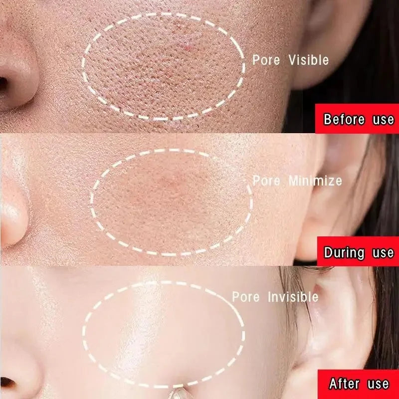 Original Facial Remove Blackhead Green Tea Solid Mask Treat Acne Blemish Black Dots Clean Stick Cream Shrink Pores Skin Care 