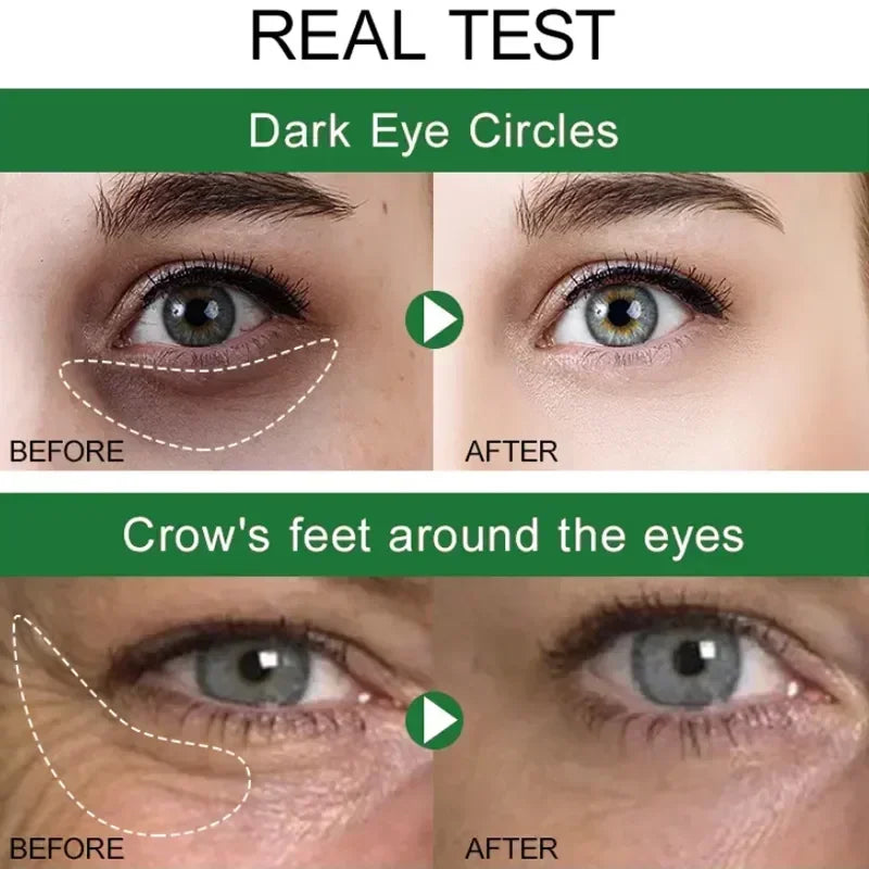 Instant Remove Wrinkles Eye Cream Fade Eye Fine Line Anti Aging Dark Circles Bags Puffiness Tighten Under Eyes Skin Care 2024