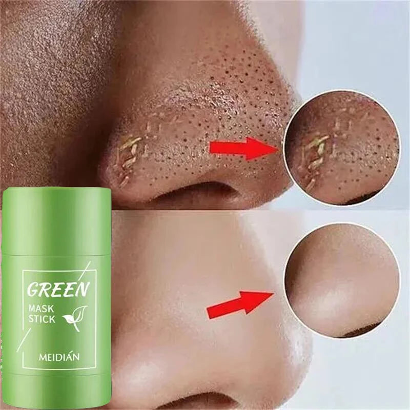 Original Facial Remove Blackhead Green Tea Solid Mask Treat Acne Blemish Black Dots Clean Stick Cream Shrink Pores Skin Care 