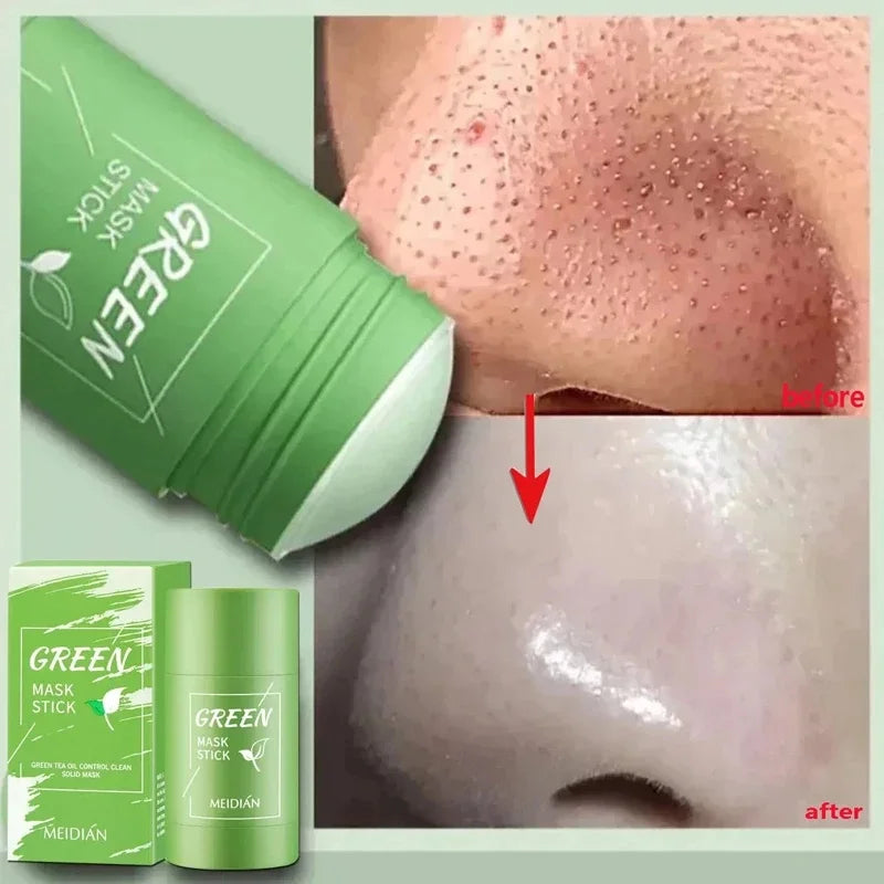 Original Facial Remove Blackhead Green Tea Solid Mask Treat Acne Blemish Black Dots Clean Stick Cream Shrink Pores Skin Care 