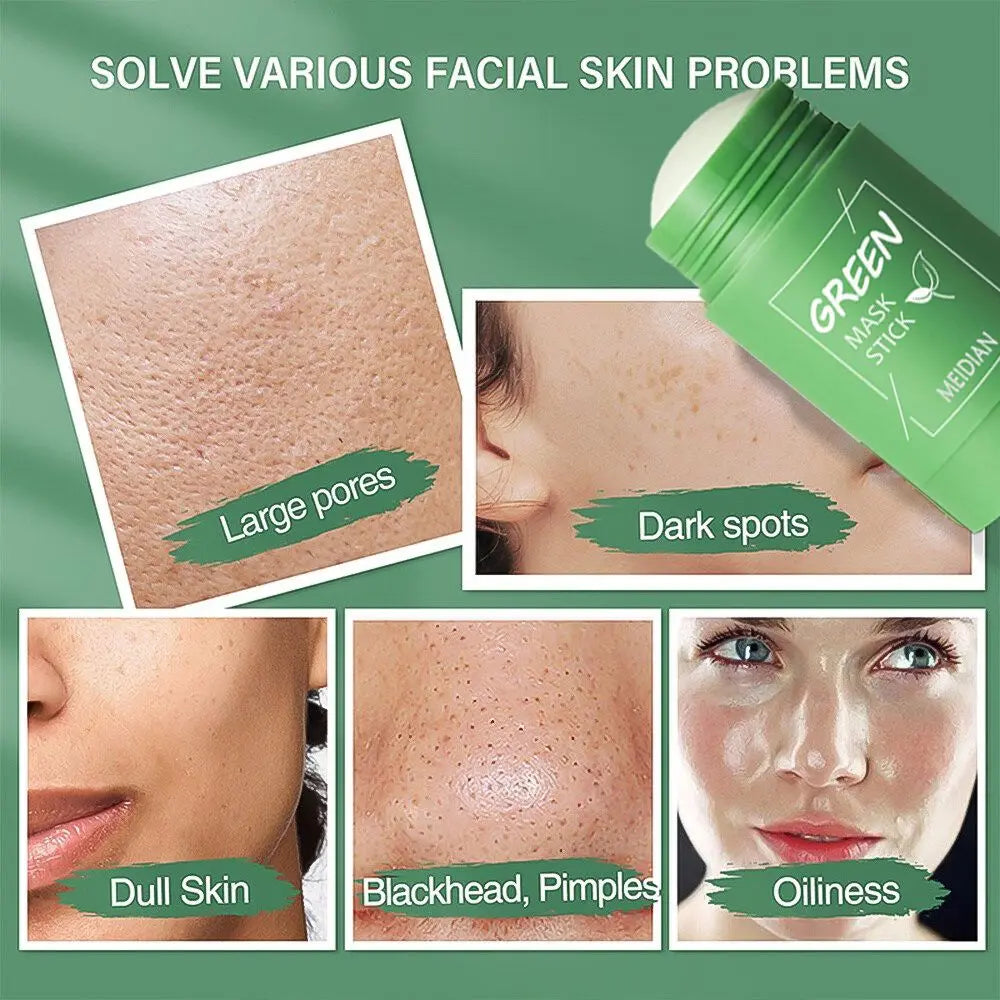 Original Facial Remove Blackhead Green Tea Solid Mask Treat Acne Blemish Black Dots Clean Stick Cream Shrink Pores Skin Care 