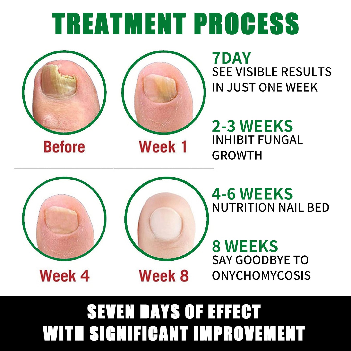 1-5Pcs Nail Fungal Treatment Device 7 Days Repair Oil Foot Toe Essence Anti Infection Paronychia Ginger Onychomycosis Gel Care