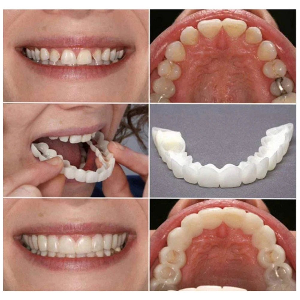 1-5Set Upper Lower Temporary Fit Fake Teeth Cosmetic Denture Smile Veneers False Teeth Brace Cover Upper False Tooth Cover Snap