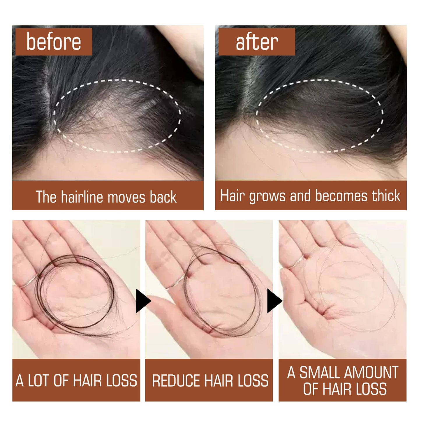 100% Natural Unrefined and Organic Batana Oil for Hair Growth & Strength, Prevents Hair Loss Eliminates Split Ends for Men Women