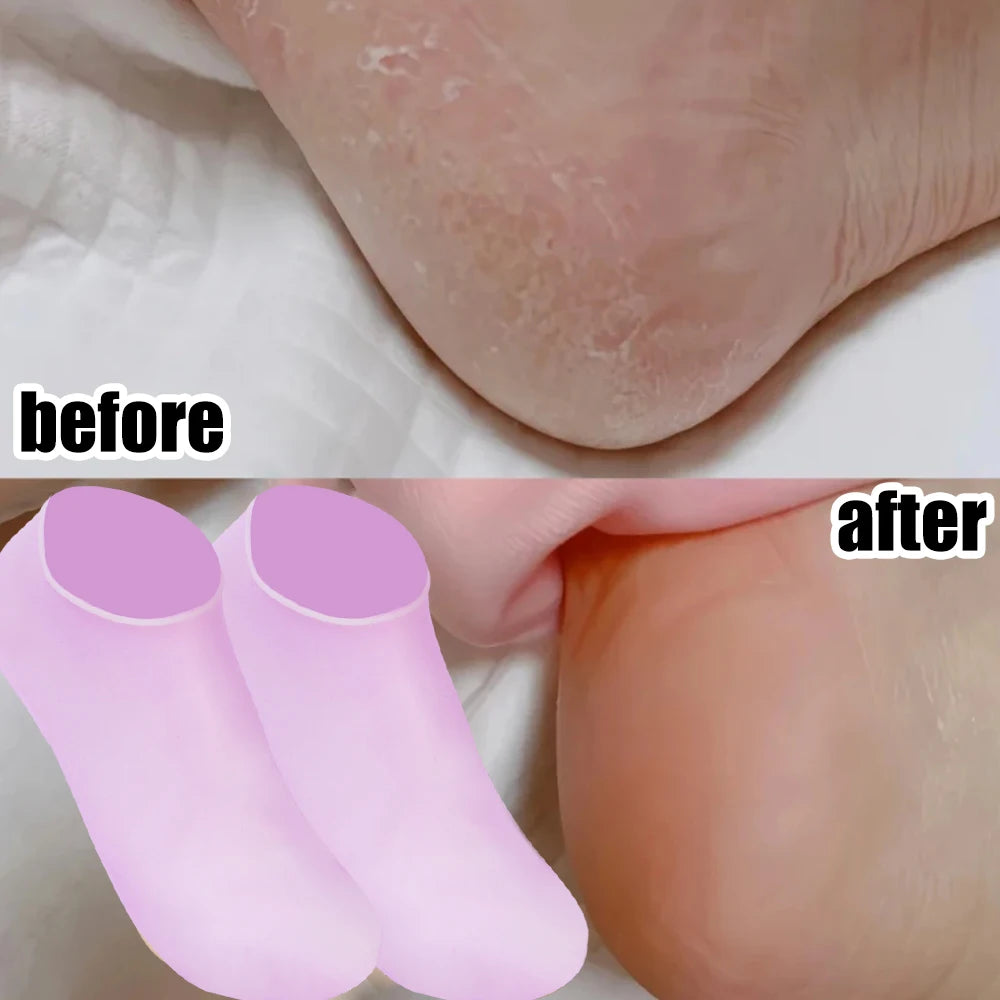 1/3pairs Silicone Moisturizing Foot Socks Anti Cracking Dry Dead Skin Foot Spa Tools Reusable Gel Stocking Protective Feet Cover